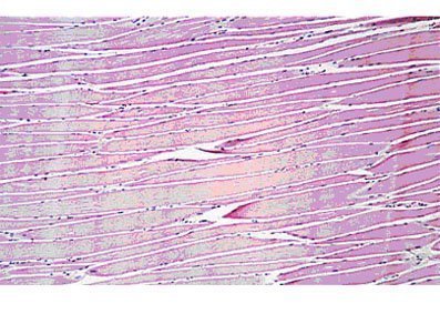 músculo esquelético músculo esquelético